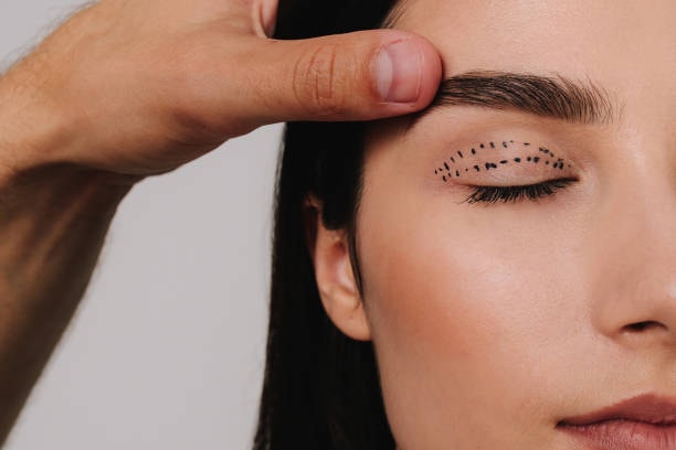 Blefaroplastia superior e inferior
